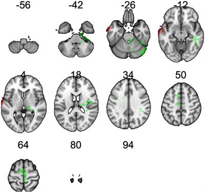 The relationship between fat mass and obesity associated gene polymorphism rs9939609 and resting cerebral blood flow in a midlife sample with overweight and obesity